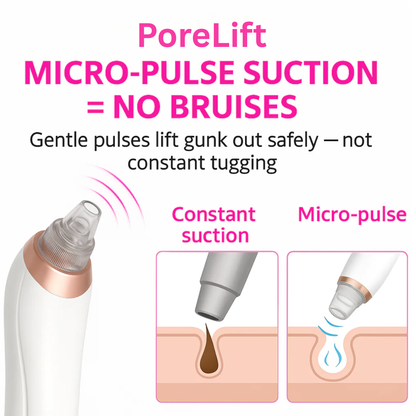 PoreLift Blackhead Remover Vacuum